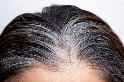 جلوگیری از سفید شدن موها با بسته سلامت فوراور